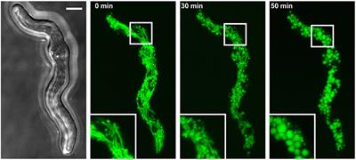 Mitochondrial Fragmentation in Aspergillus fumigatus as Early Marker of Granulocyte Killing Activity